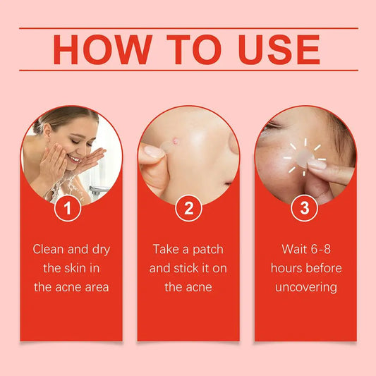 Anti-Acne Waterproof Spot and Marks Concealer - BLAKESTORE-NG