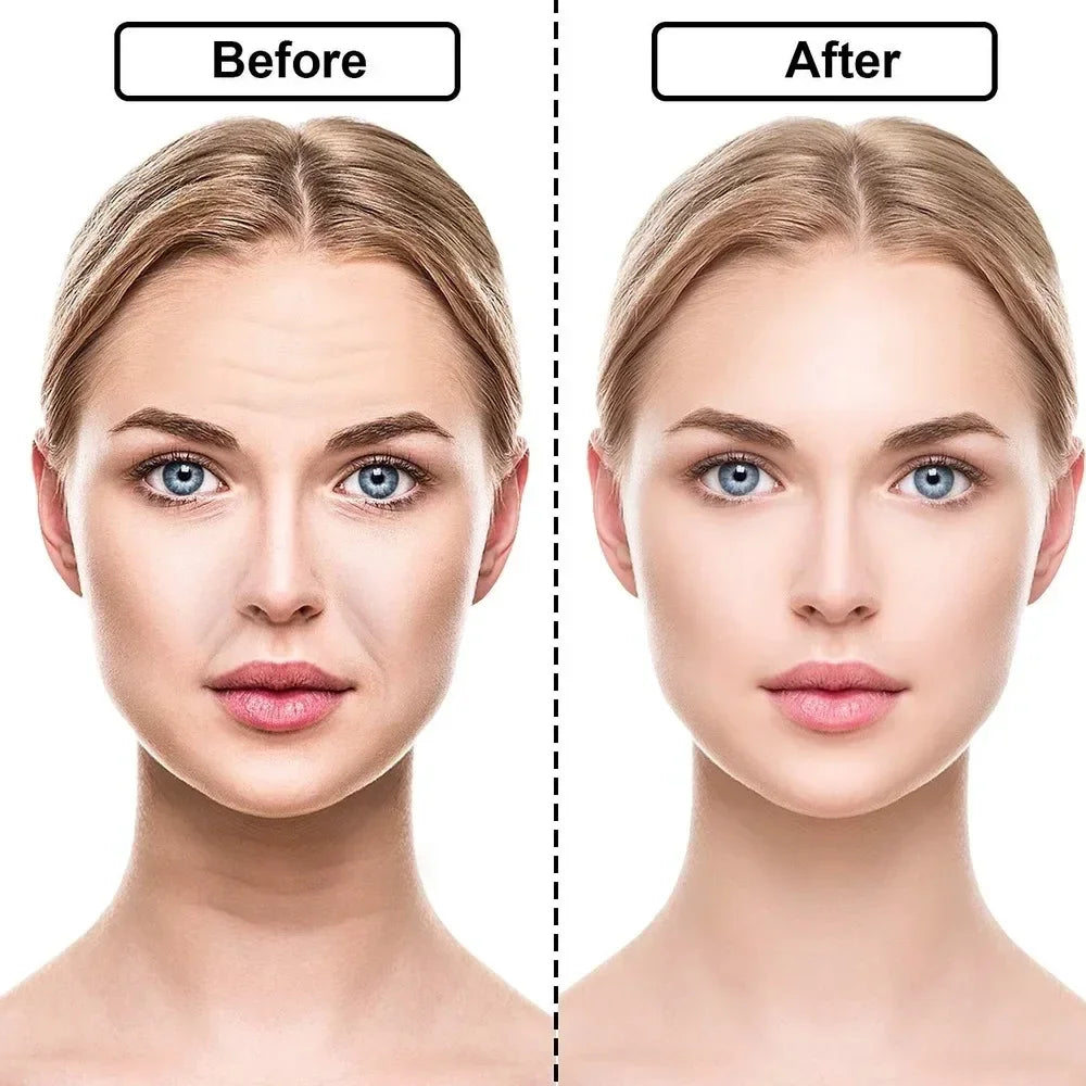 Reusable Silicone Wrinkle Removal Sticker. Forehead Neck Eye Wrinkle Removal Stickers. Anti Aging and Face Lifting Patches. - BLAKESTORE-NG