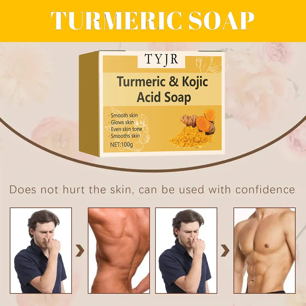 Tumeric Soap for Acne Cure.