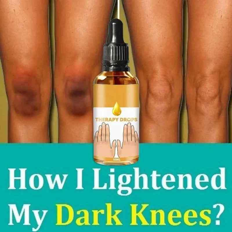 Dark Knuckles Remover Serum. - BLAKESTORE-NG