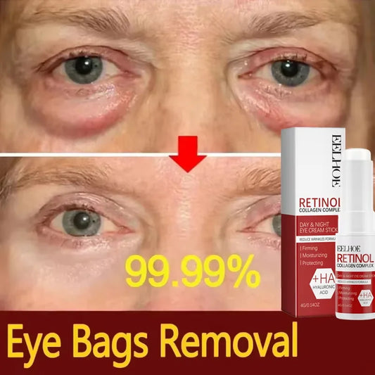 Retinol Eye Balm Stick. Reduce Wrinkles Eye Bag, Dark Circle and Eye Puffiness - BLAKESTORE-NG