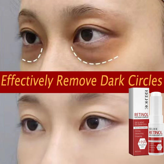 BLAKESTORE-NG Dark Circle Retinol Eye Balm Stick. Reduce Wrinkles Eye Bag, Dark Circle and Eye Puffiness