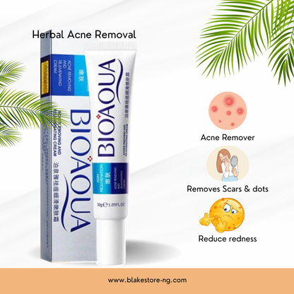 Herbal Acne Removal Face Cream.