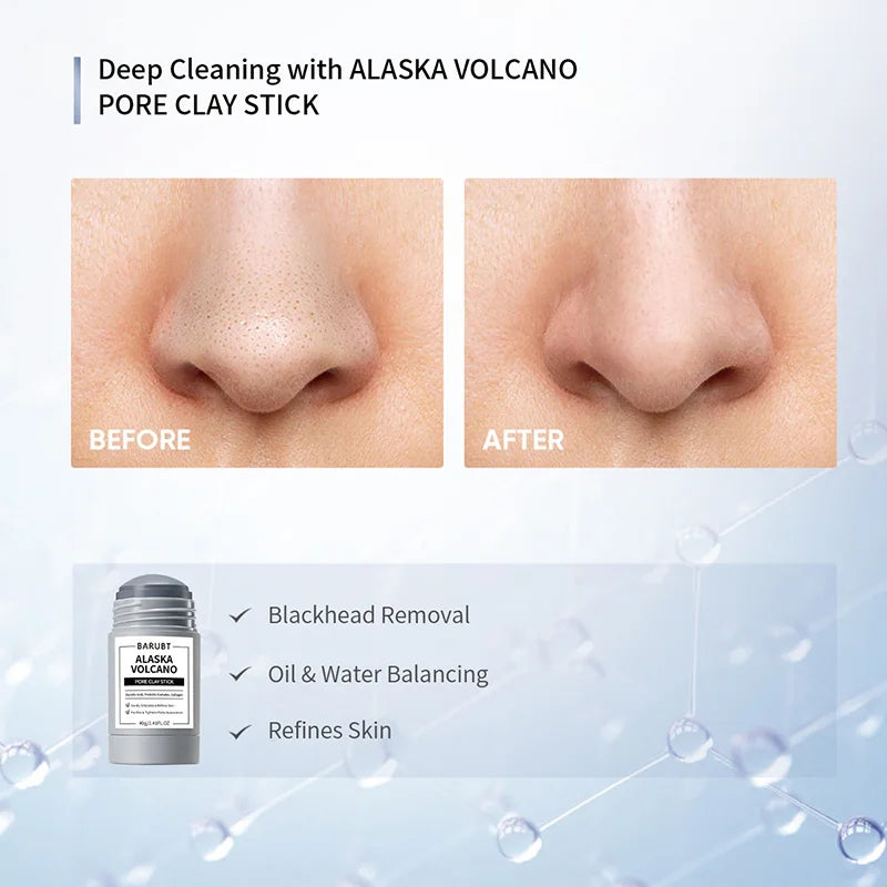 Deep Cleaning Mud Mask. - BLAKESTORE-NG