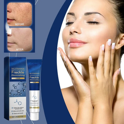 Face Dark Skin Brightening Cream. - BLAKESTORE-NG
