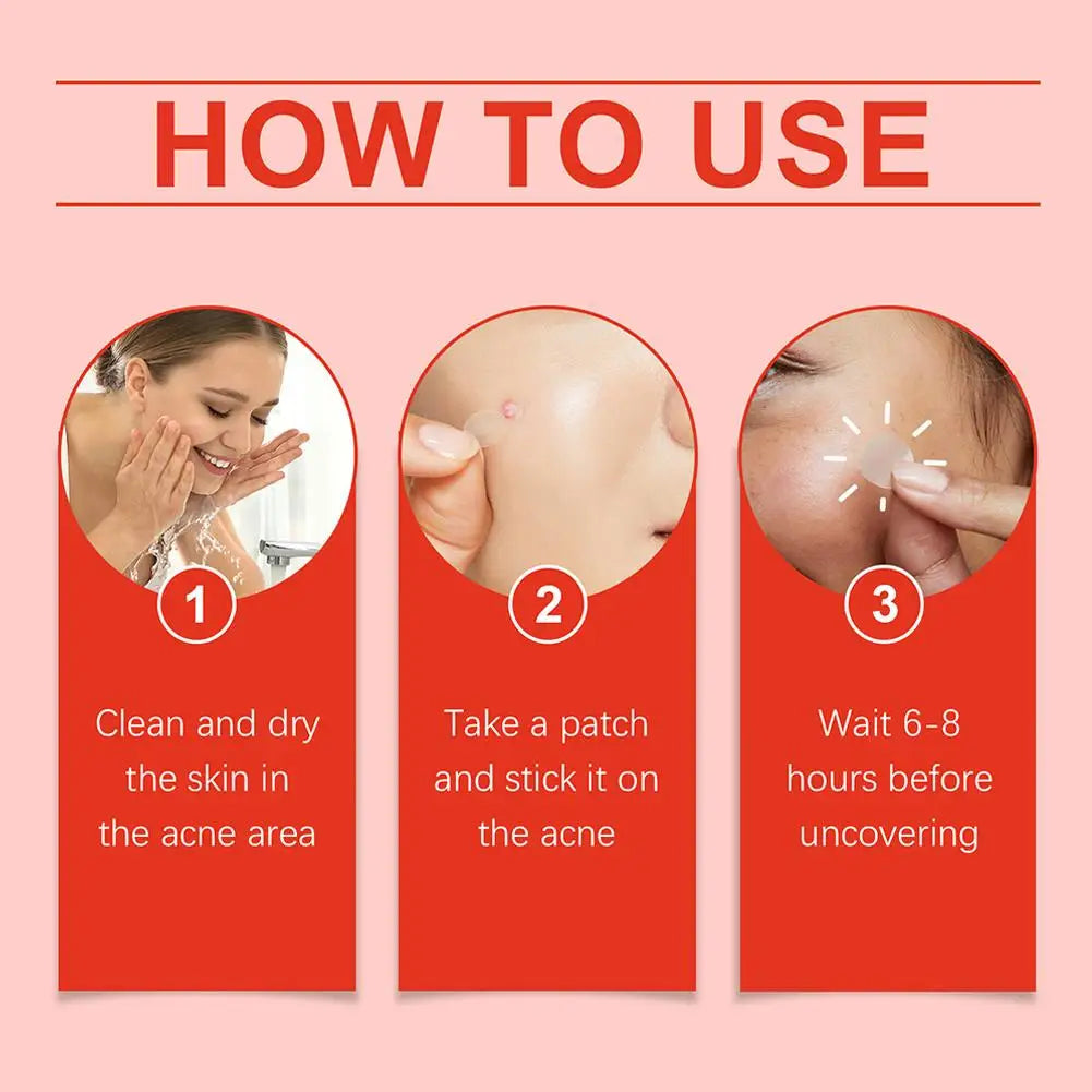 Anti-Acne Waterproof Spot and Marks Concealer - BLAKESTORE-NG