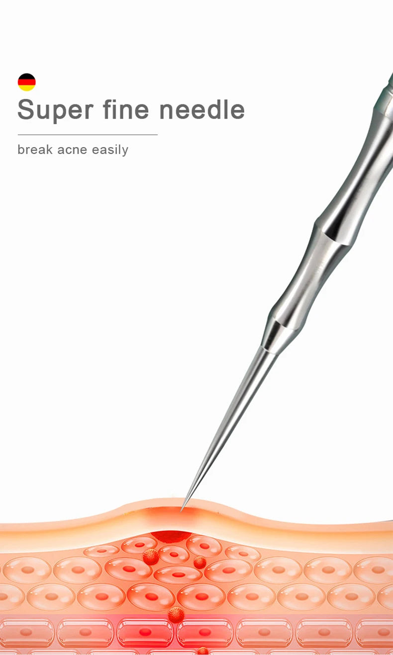 Acne and Pimples Removal Needles. - BLAKESTORE-NG