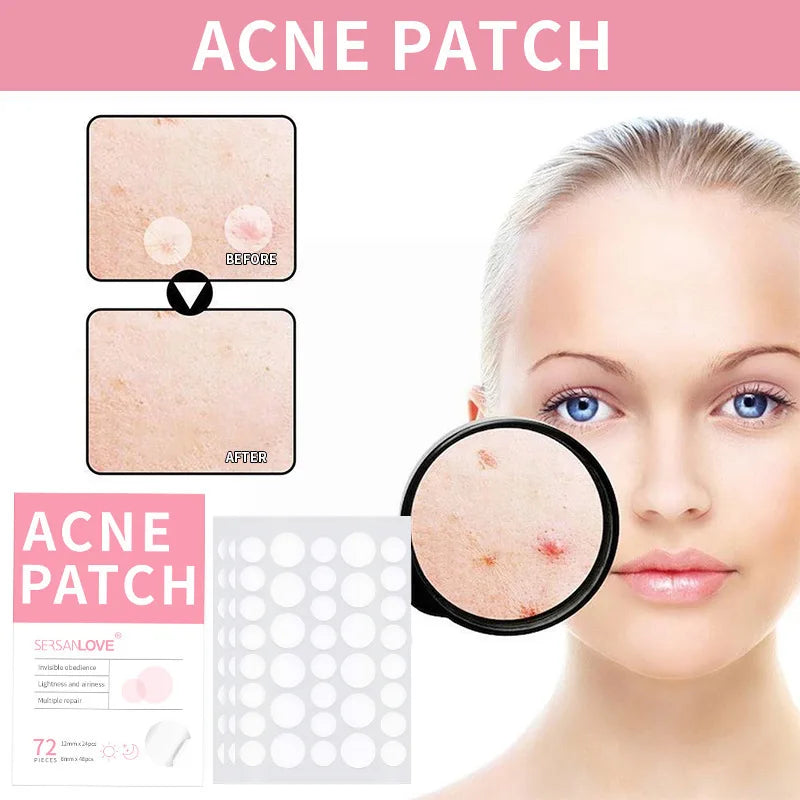 Acne and Pimple Removal And Spots Repair Stickers. - BLAKESTORE-NG