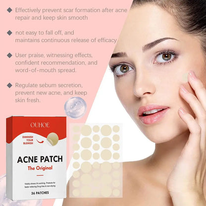 Anti-Acne Waterproof Spot and Marks Concealer - BLAKESTORE-NG