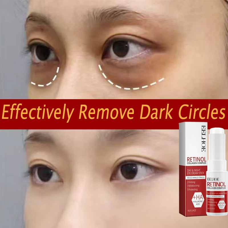 Retinol Eye Balm Stick. Reduce Wrinkles Eye Bag, Dark Circle and Eye Puffiness - BLAKESTORE-NG