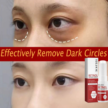 Retinol Eye Balm Stick. Reduce Wrinkles Eye Bag, Dark Circle and Eye Puffiness - BLAKESTORE-NG