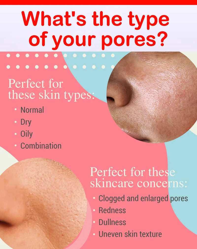 Acne Treatment Anti Aging Serum. - BLAKESTORE-NG