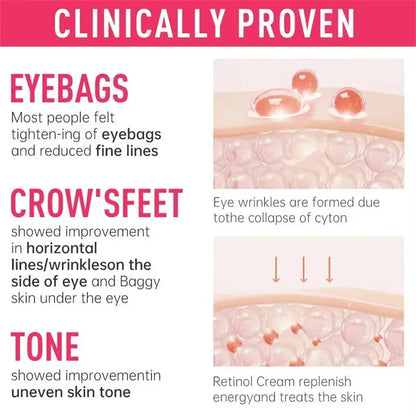 Eye Bag and Dark Circle Removal - BLAKESTORE-NG