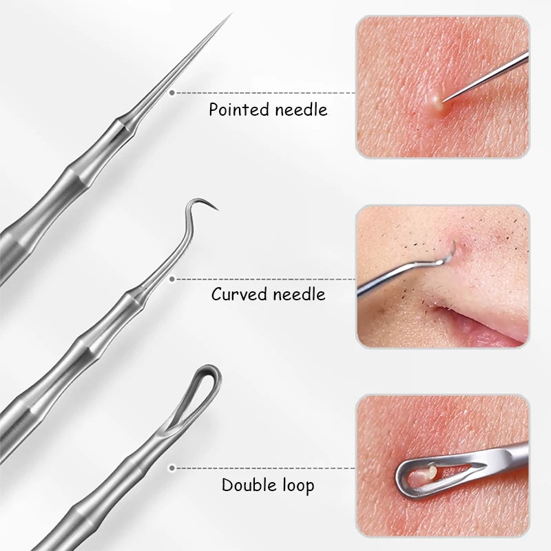 Acne and Pimples Removal Needles. - BLAKESTORE-NG