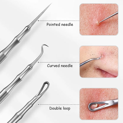 Acne and Pimples Removal Needles. - BLAKESTORE-NG