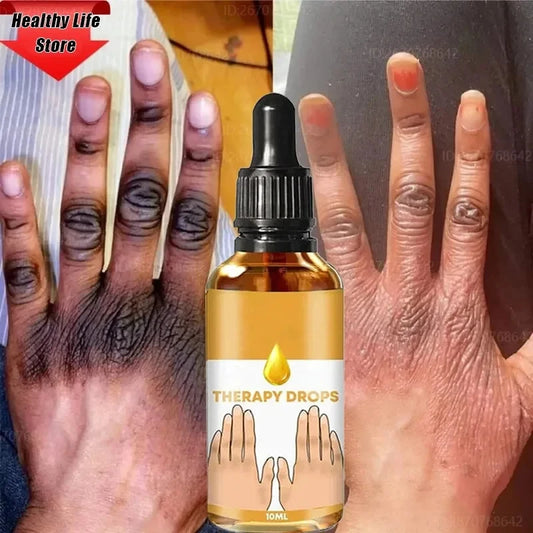 Dark Knuckles Remover Serum. - BLAKESTORE-NG