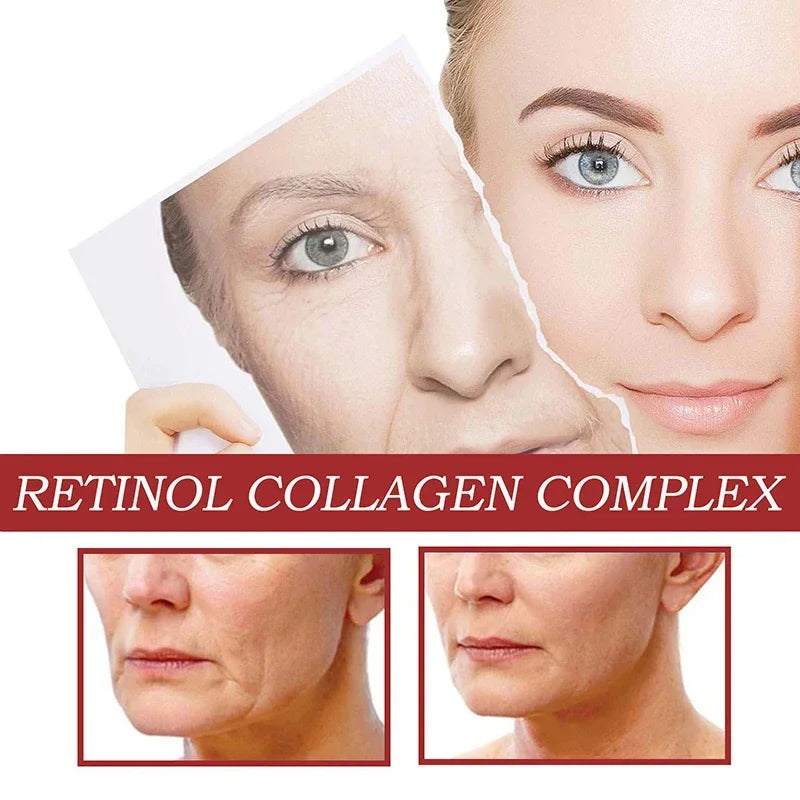 Retinol Eye Balm Stick. Reduce Wrinkles Eye Bag, Dark Circle and Eye Puffiness - BLAKESTORE-NG