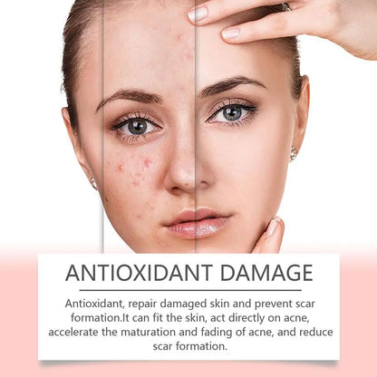 Anti-Acne Waterproof Spot and Marks Concealer - BLAKESTORE-NG