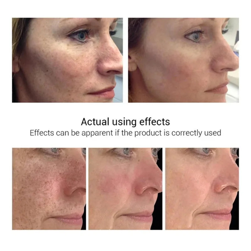 Face Dark Skin Brightening Cream. - BLAKESTORE-NG