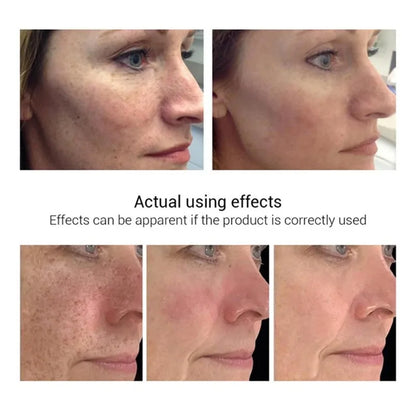 Face Dark Skin Brightening Cream. - BLAKESTORE-NG