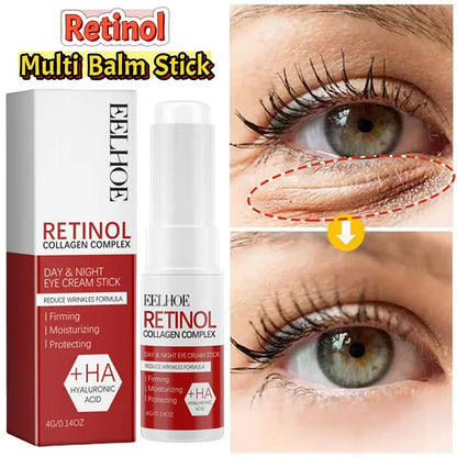 Retinol Eye Balm Stick. Reduce Wrinkles Eye Bag, Dark Circle and Eye Puffiness - BLAKESTORE-NG