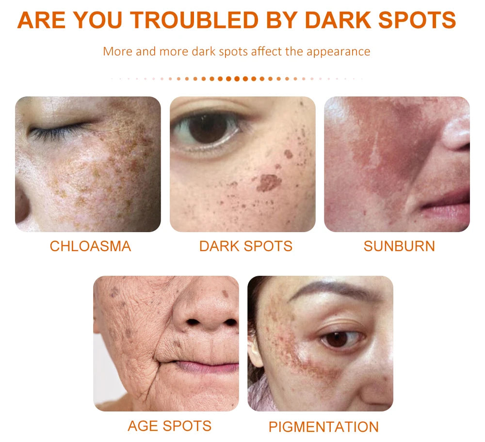 Vitamin C Dark Spot Remover Day and Night Use - BLAKESTORE-NG