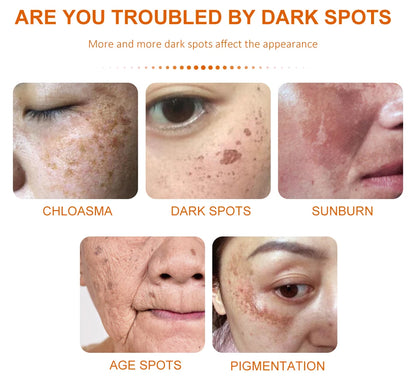 Vitamin C Dark Spot Remover Day and Night Use - BLAKESTORE-NG