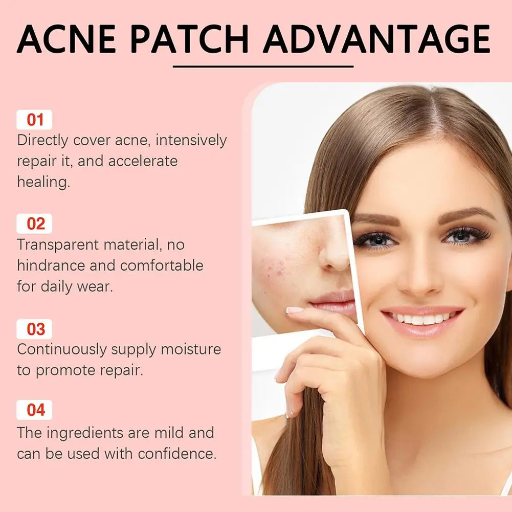 Anti-Acne Waterproof Spot and Marks Concealer - BLAKESTORE-NG