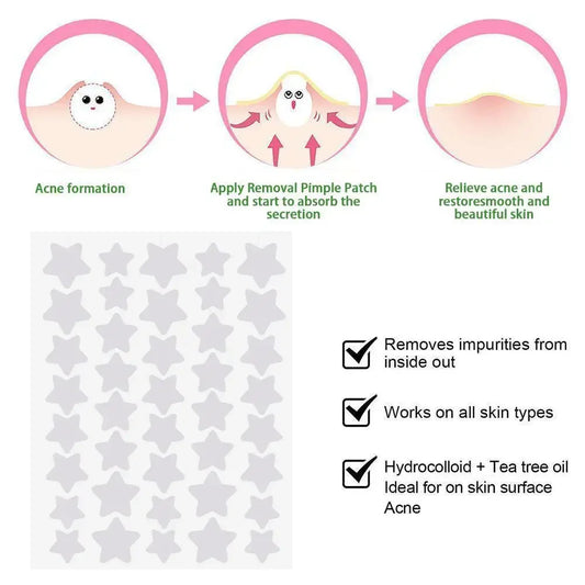 Anti Acne Invisible Concealer. - BLAKESTORE-NG