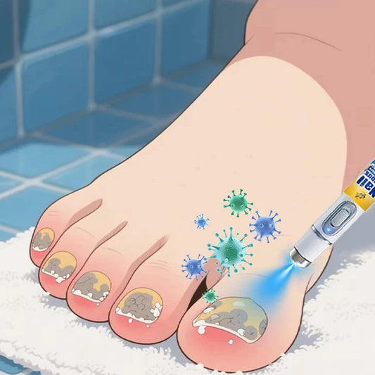 Fungal Nail Repair Essence – Restore Natural Shine & Eliminate Onychomycosis