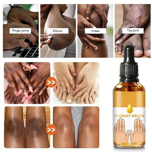 Dark Knuckles Remover Serum. - BLAKESTORE-NG