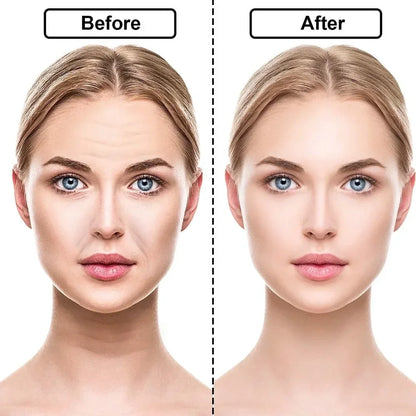 Reusable Silicone Wrinkle Removal Sticker. Forehead Neck Eye Wrinkle Removal Stickers. Anti Aging and Face Lifting Patches. - BLAKESTORE-NG