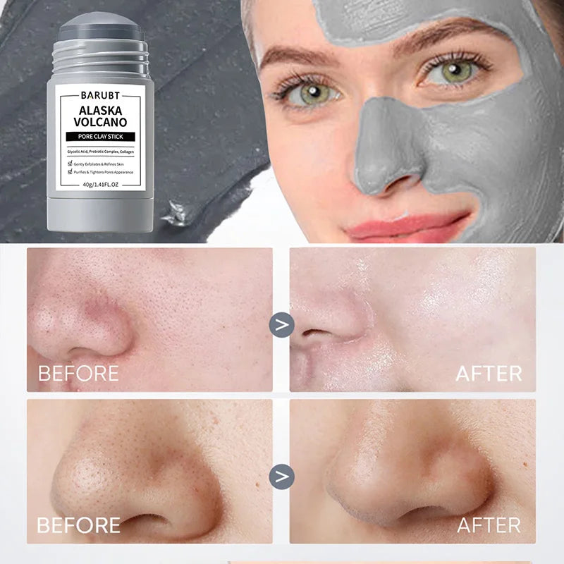 Deep Cleaning Mud Mask. - BLAKESTORE-NG