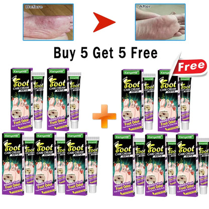 Anti-Foot Fungus Cream