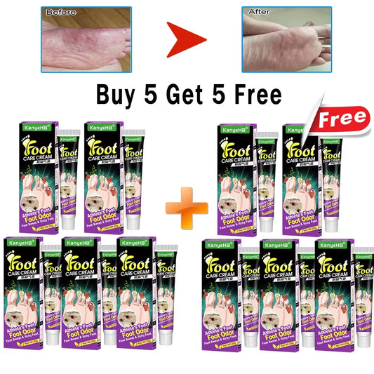 Anti-Foot Fungus Cream