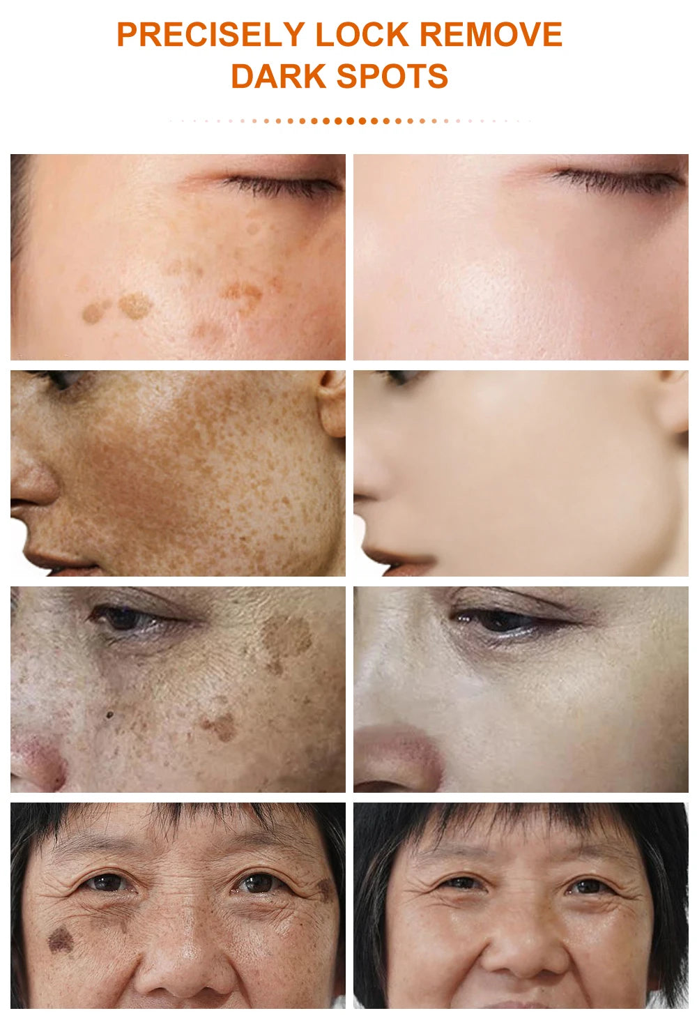 Vitamin C Dark Spot Remover Day and Night Use - BLAKESTORE-NG