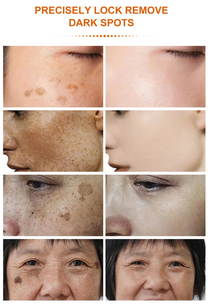 Vitamin C Dark Spot Remover Day and Night Use - BLAKESTORE-NG