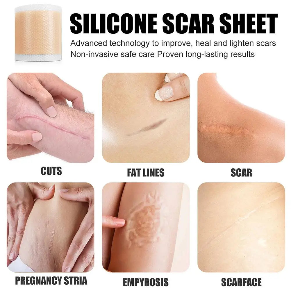 Acne And Burn Scar Sheet Patch Treatment. - BLAKESTORE-NG