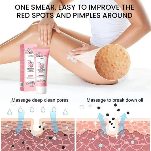 Keratosis Pilaris Repair Cream | Exfoliating & Moisturizing Body Treatment