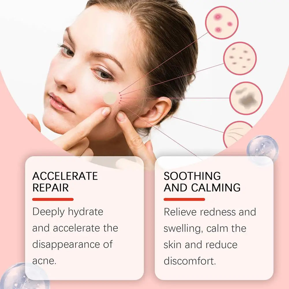 Anti-Acne Waterproof Spot and Marks Concealer - BLAKESTORE-NG