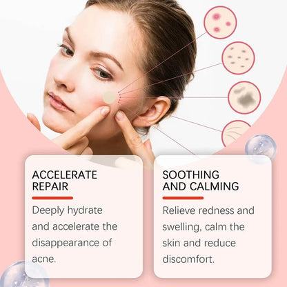 Anti-Acne Waterproof Spot and Marks Concealer - BLAKESTORE-NG