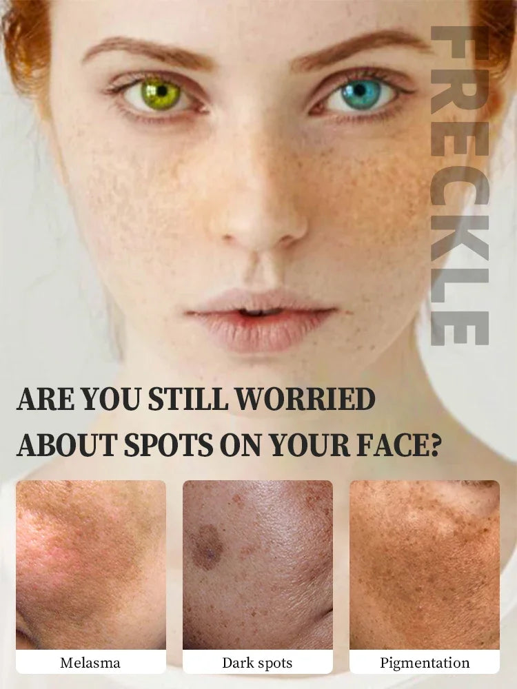 Face Dark Skin Brightening Cream. - BLAKESTORE-NG