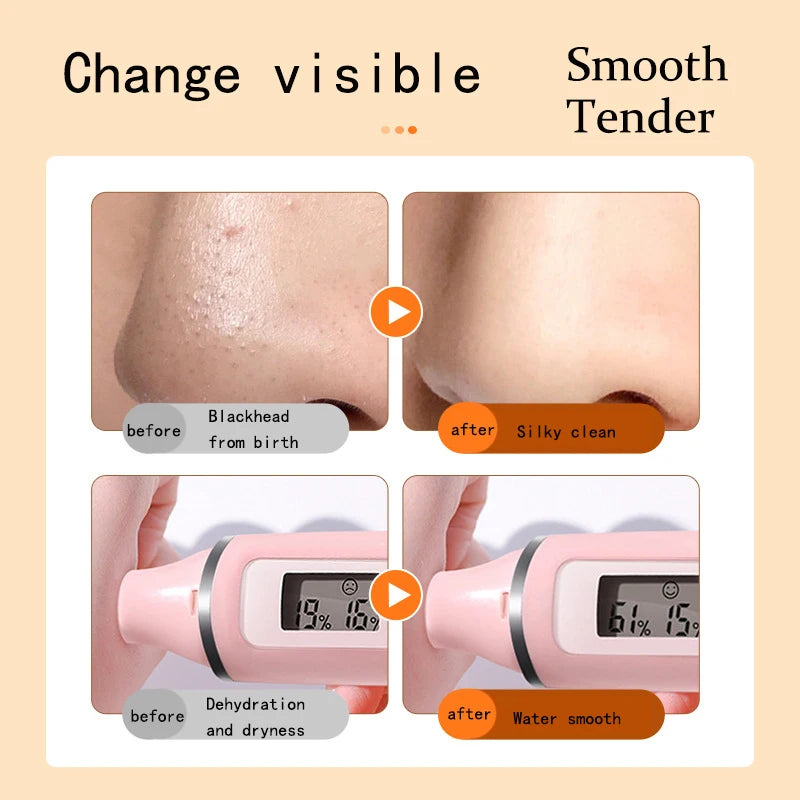 Bubble Mask Face Cleaning for Acne Treatment - BLAKESTORE-NG