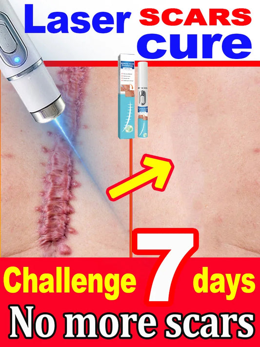 Scar Keloid Laser Removal - BLAKESTORE-NG