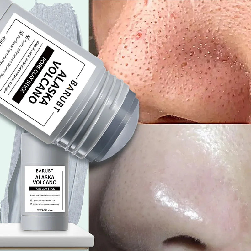 Deep Cleaning Mud Mask. - BLAKESTORE-NG