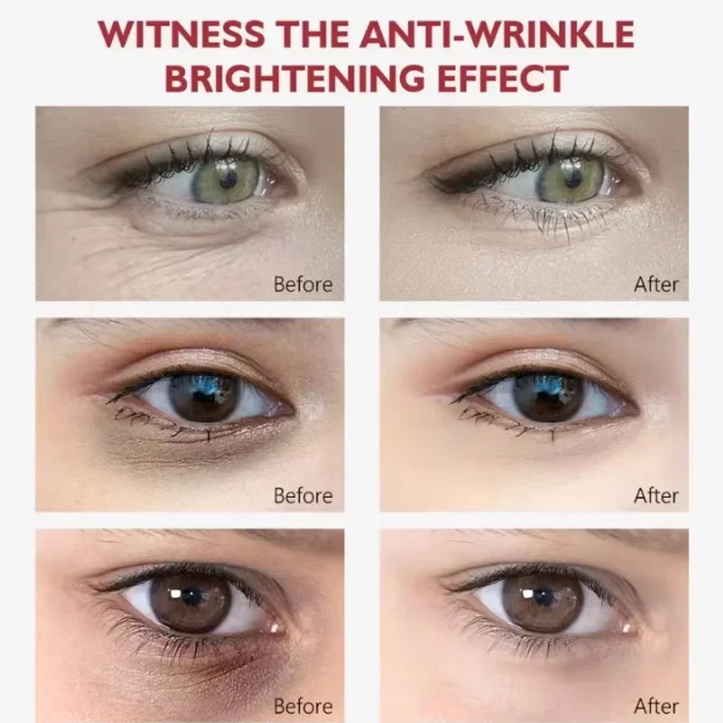 Retinol Eye Balm Stick. Reduce Wrinkles Eye Bag, Dark Circle and Eye Puffiness - BLAKESTORE-NG