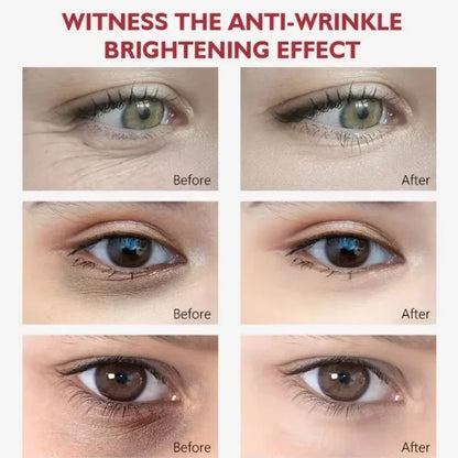Retinol Eye Balm Stick. Reduce Wrinkles Eye Bag, Dark Circle and Eye Puffiness - BLAKESTORE-NG