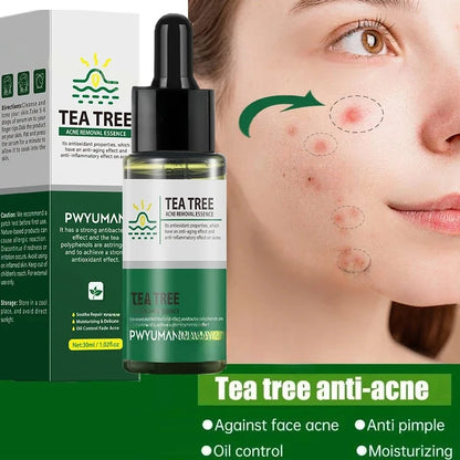 Acne and Blackhead Serum. - BLAKESTORE-NG