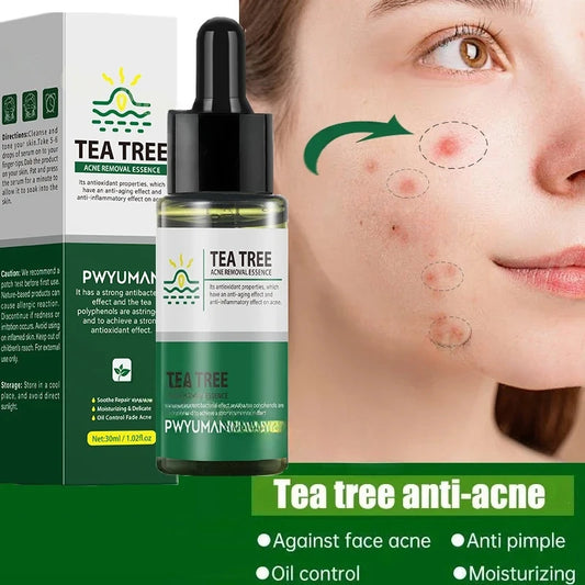 Acne and Blackhead Serum. - BLAKESTORE-NG