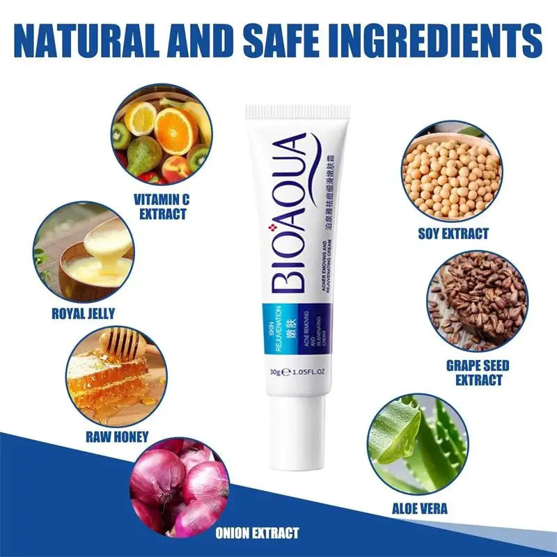 Herbal Acne Removal Face Cream.